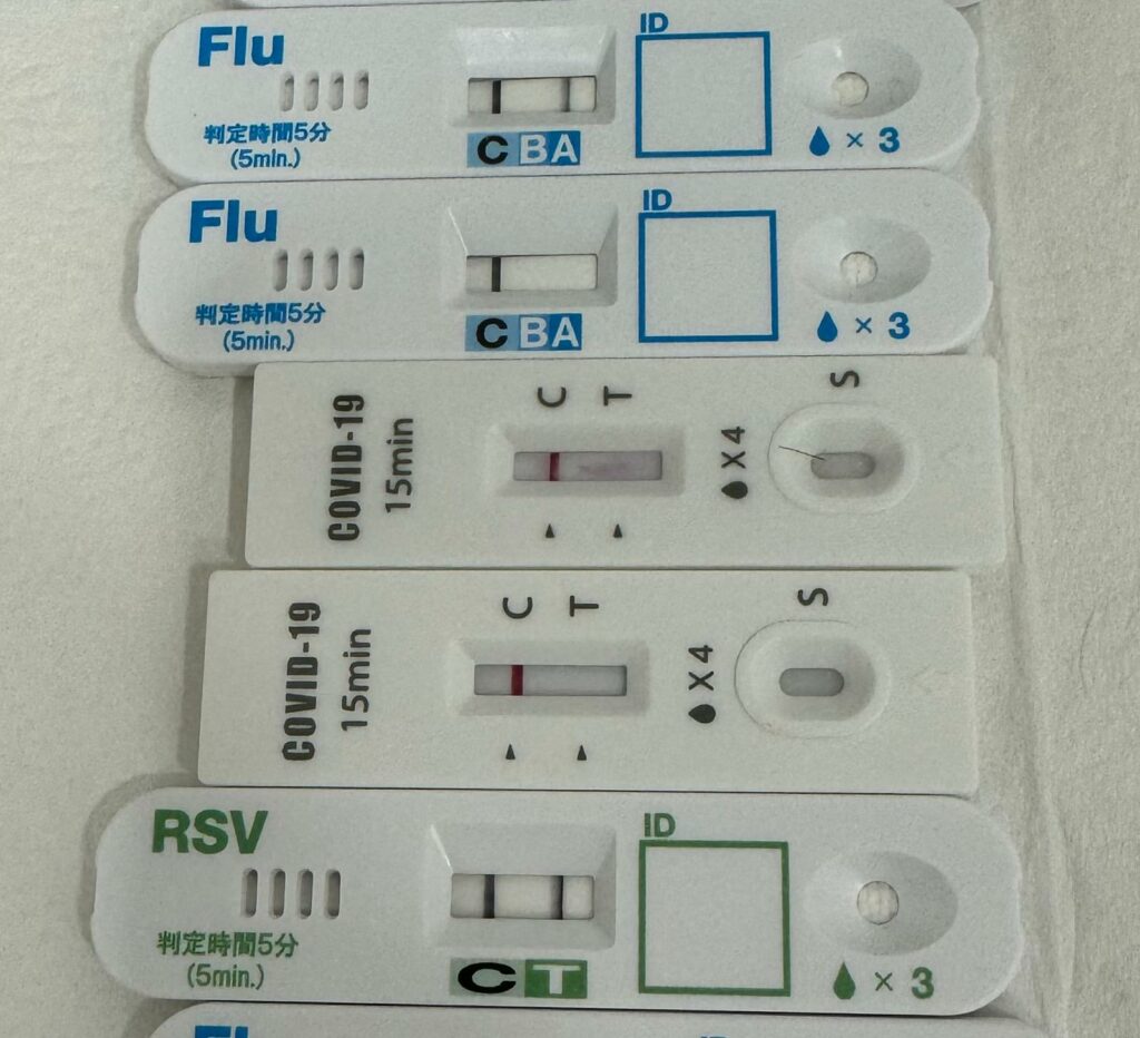 Influenza Testing Positive, RSV Positive. Viral Testing in Paddington Medical